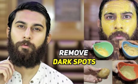 6 Cures to Remove Dark Spots