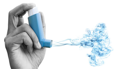 When Are Steroids Recommended for Treatment of Asthma?