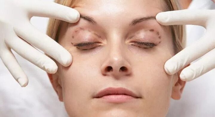 Get Affordable and effective Facial Cosmetic Surgery at Westside Face